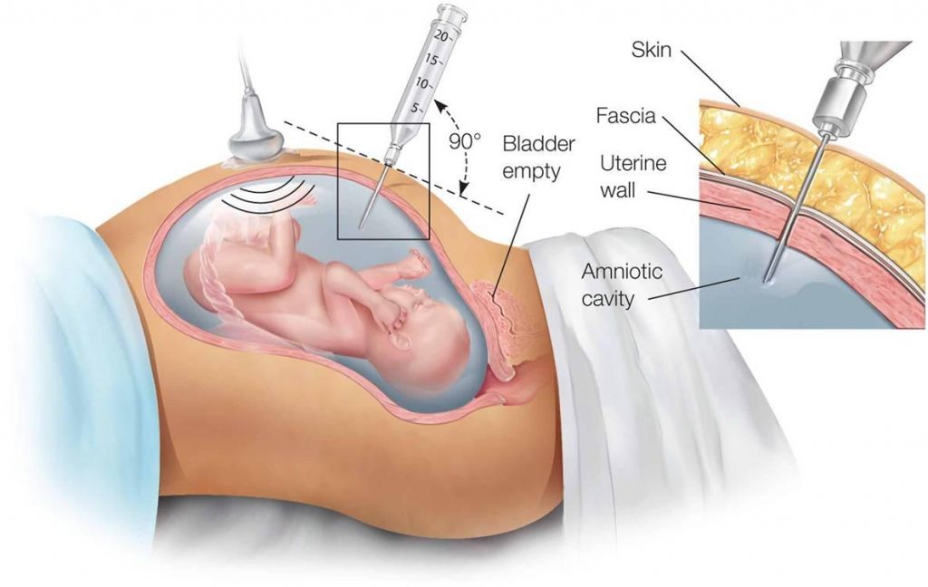 Các xét nghiệm cần thiết trong thai kỳ mẹ bầu cần thực hiện